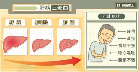 C肝不治染新冠死亡風險增加，切莫拖延篩檢及治療！肝炎專家圖文解析 台灣肝臟研究學會 財團法人台灣肝臟研究暨教育基金會