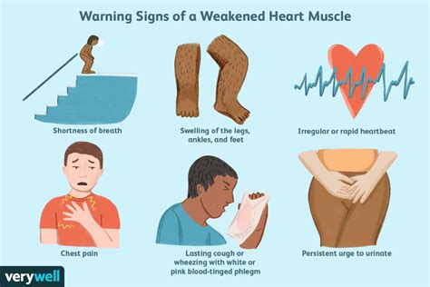 How To Find Out If You Have Heart Disease Gradecontext26