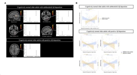 A Brain Regions Showing A Significant Difference In The Regional