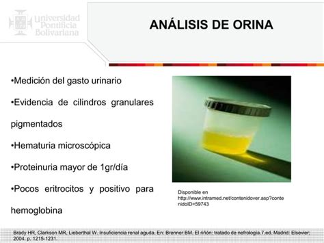 Necrosis Tubular Aguda PPT