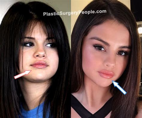 Selena Gomez: BEFORE and AFTER 2022