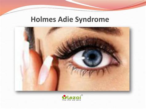 PPT - Holmes-Adie Syndrome (Adie’s Pupil): An overview of symptoms, causes, diagnosis and ...