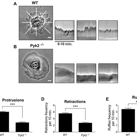 Regulation Of Cell Edge Protrusion Dynamics In Fibroblasts Depends On