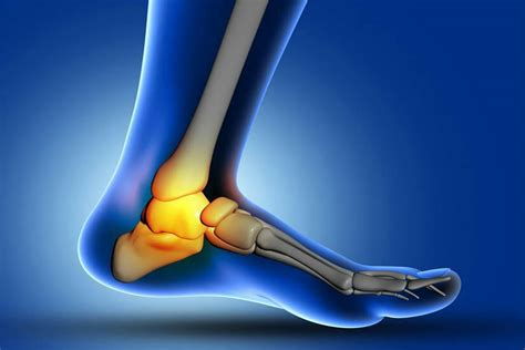 Chronic Lateral Ankle Pain: Causes and Treatment Option