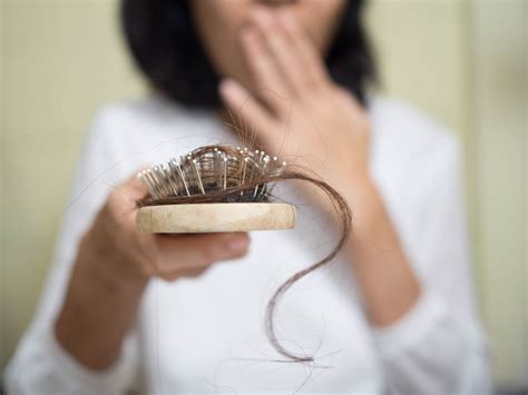 Hair Falling Out In Clumps Causes Diagnosis And Treatment