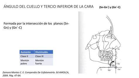 An Lisis De Dr Legan Y Burstone Pptx