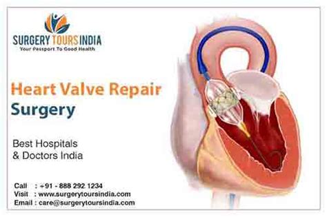 Heart Valve Repair Surgery - Cancer Surgery India