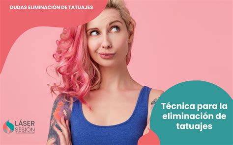 T Cnica Para Eliminar Tatuajes Lasersesion