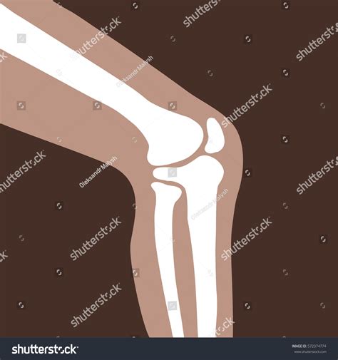 Vector Human Knee Joint Side View Stock Vector Royalty Free 572374774