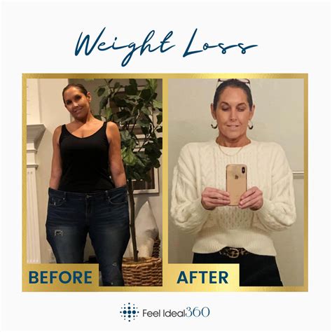 Weight Loss Transformation Before And After Feel Ideal 360 Med Spa