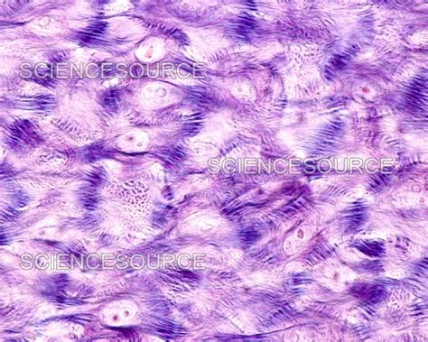 Photograph | Epidermis, Stratum Spinosum, Desmosome | Science Source Images