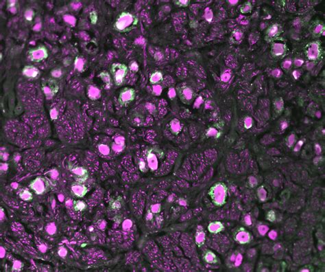 Study Finds Key Similarities Between Rodent And Human Satellite Glial