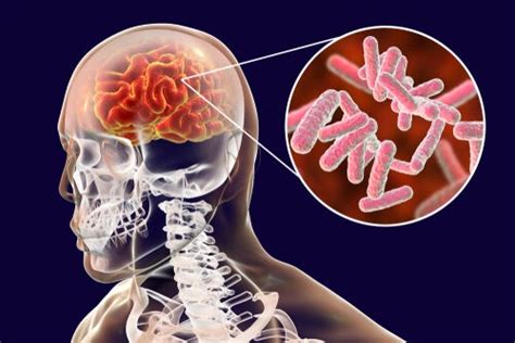 The Hindbrain: Structure and Functions - Exploring your mind