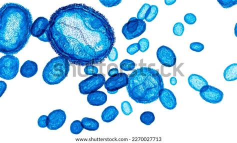 2,299 Caused Blisters Images, Stock Photos & Vectors | Shutterstock