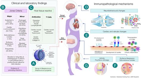 Clinical And Immunopathological Features Of Acute Rheumatic Fever And Download Scientific