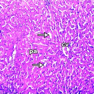 Photomicrograph Of Liver Showing Thin Capsule Glisson S Capsule