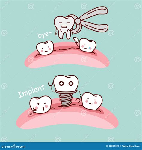 Cartoon Tooth Extract And Implant Stock Vector Image 62201095