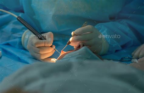 ophthalmologist performs an operation on the patient's eye. Stock Photo ...