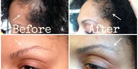 My Eyebrow And Edge Growth Journey Melting Pot Beauty