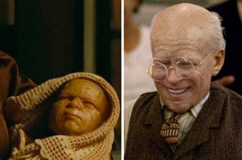 Benjamin Button Es Real Nace Bebé Anciano Conmueve Las Redes Sociales