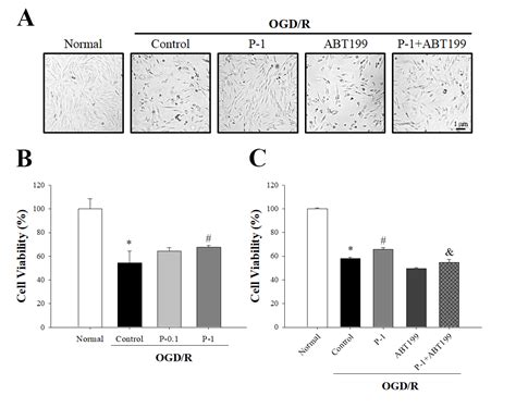 Paeonol Protects Against Myocardial Ischemia Reperfusion Induced Injury