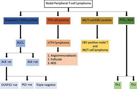 The Algorithm For Diagnosing Nodal Peripheral T Cell Lymphomas ALCL