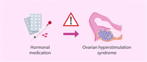 What Are the Risks of In Vitro Fertilization (IVF)?