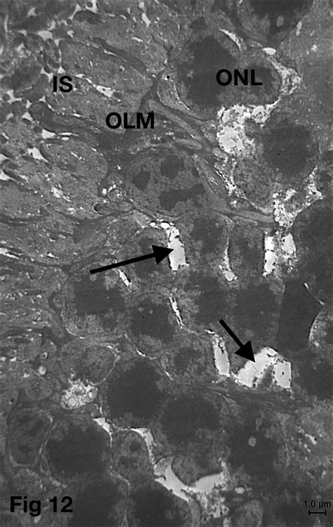 An Electron Micrograph Of Ultrathin Section Of Photoreceptors Of Group