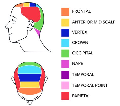 Hair Loss Chart | Hair Loss Scale | Cooley Hair Center