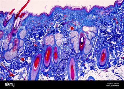 Piel humana que muestra epidermis dermis pelos glándulas sebáceas y