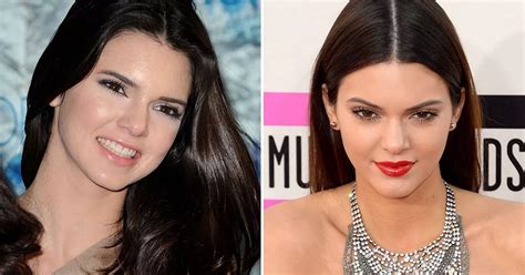 Has Kendall Jenner had a nose job? Reality star's thinner features ...