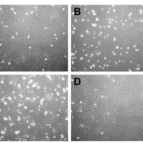 Phase Contrast Micrographs Recorded From 661W Cells Treated With