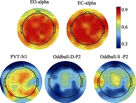 Test Retest Reliability Of EEG A Comparison Across Multiple Resting