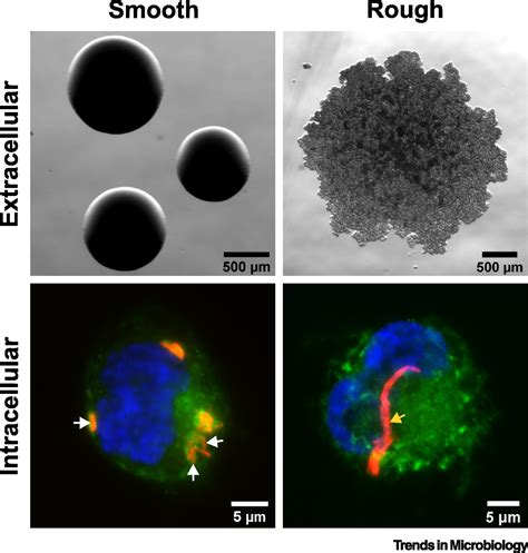 Mycobacterium Abscessus Trends In Microbiology