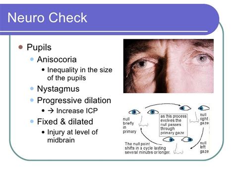 Neuro Check Pupils Assessment Geriatric Nursing Paramedic School