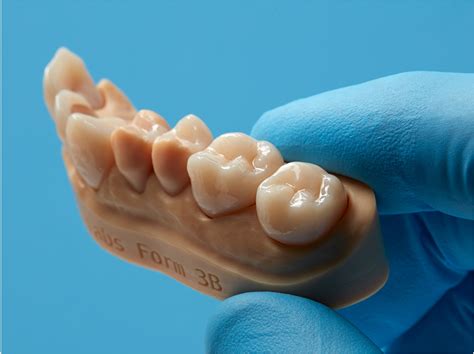 3 D Printing Resin Designed For Permanent Crowns Dentistry Today