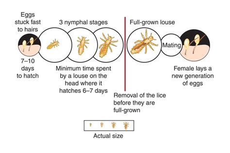 Head Lice What They Are And How To Get Rid Of Them Ausmed