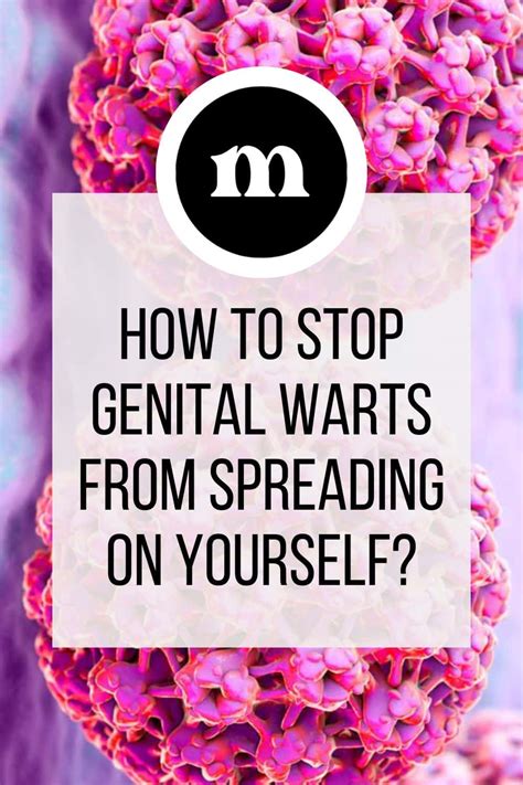 How To Stop Genital Warts From Spreading On Yourself