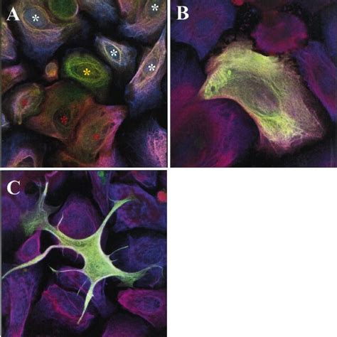 Morphology Of The Prostate Epithelial Cell Culture Gland Like Buds And