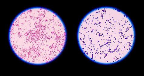 Staining Techniques: Gram staining, Acid Fast Bacilli, Spore, and ...