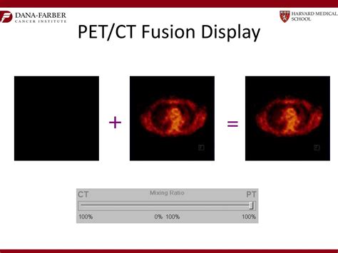 Ppt Introduction To Pet Ct In Oncology Practical Aspects Powerpoint