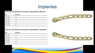 Osteosíntesis de fractura de humero distal pptx