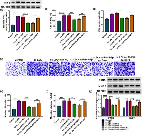 Knockdown Of Circ 0113656 Assuages Oxidized Low Density Lipoprotein