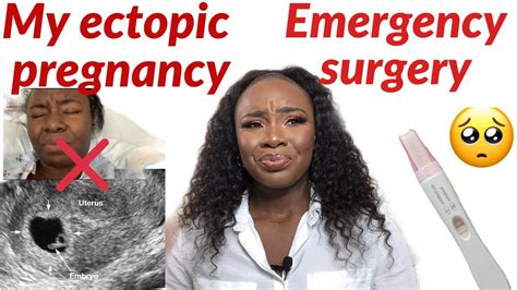 My Ectopic Pregnancy Story Emergency Surgery Misscarriage Youtube