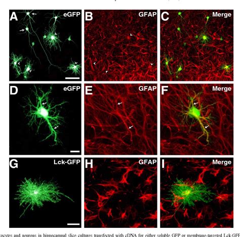 Figure From Ballistic Labeling And Dynamic Imaging Of Astrocytes In