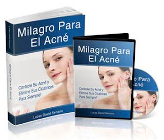 Como Eliminar El Acne, Barros o Espinillas: Como Eliminar Los Barros y ...