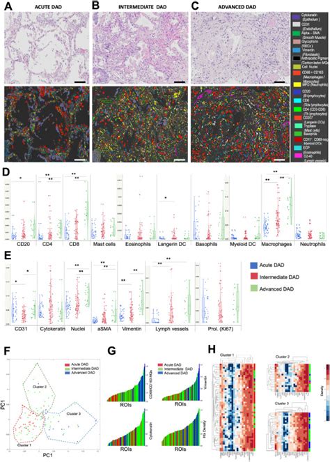 Diffuse Alveolar Damage Patterns Reflect The Immunological And