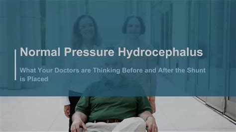 Normal Pressure Hydrocephalus What Your Doctors Are Thinking Before