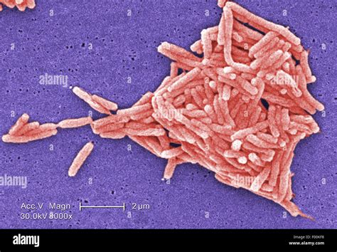 Colorized Scanning Electron Micrograph Sem Depicted A Grouping Of