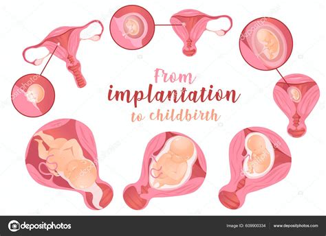 Embarazo Conjunto Realista Paquete Anatomía Femenina Infografía Médica